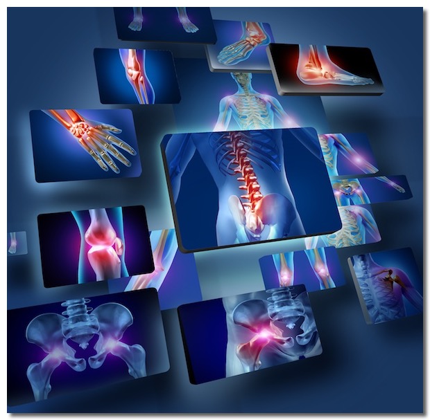 symptomes chiropraxie