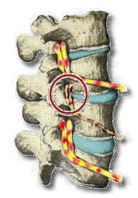 subluxation animée